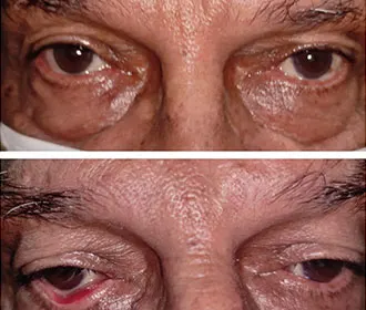 Dr. Sreekanth Eye Care and Research Centre